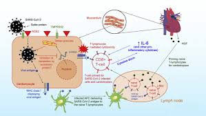 Mostly in male adolescents and . References In Recognizing Covid 19 Related Myocarditis The Possible Pathophysiology And Proposed Guideline For Diagnosis And Management Heart Rhythm