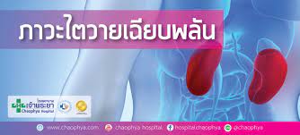 โรคไตวาย แบ่งออกได้เป็น 2 แบบ คือ แบบเฉียบพลัน และ แบบเรื้อรัง ซึ่งแนวทางในการรักษาจะแตกต่างกันไป ดังนี้ 1.โรคไตวายเฉียบพลัน (acute renal failure) 2.โรคไตวาย. à¸ à¸²à¸§à¸°à¹„à¸•à¸§à¸²à¸¢à¹€à¸‰ à¸¢à¸šà¸žà¸¥ à¸™ Acute Kidney Injury à¹‚à¸£à¸‡à¸žà¸¢à¸²à¸šà¸²à¸¥à¹€à¸ˆ à¸²à¸žà¸£à¸°à¸¢à¸²