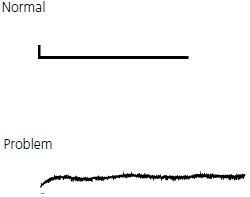 Maybe you would like to learn more about one of these? Hplc Troubleshooting Guide