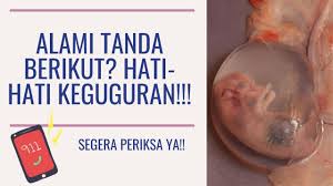 Keguguran adalah gagalnya kehamilan sebelum usia kandungan 20 minggu. Tanda Tanda Keguguran Wajib Periksa Youtube