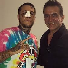 Video del escándalo de los caniggia en el faena: Alexander Caniggia Se Hizo Nariz Nueva A Quien Se Parece