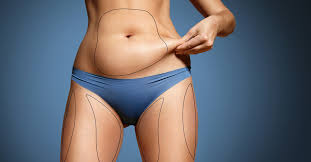 Therefore, the quality of the doctor who. Liposuction Cost Canada Starting From 1 500 Request A Consultation
