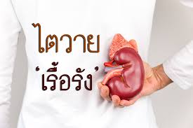 ไตวายเรื้อรัง (chronic kidney failure หรือ chronic renal failure) อาการของไตวายเรื้อรังจะไม่เกิดขึ้น à¹„à¸•à¸§à¸²à¸¢à¹€à¸£ à¸­à¸£ à¸‡ Thaihealth Or Th à¸ªà¸³à¸™ à¸à¸‡à¸²à¸™à¸à¸­à¸‡à¸— à¸™à¸ªà¸™ à¸šà¸ªà¸™ à¸™à¸à¸²à¸£à¸ªà¸£ à¸²à¸‡à¹€à¸ªà¸£ à¸¡à¸ª à¸‚à¸ à¸²à¸ž à¸ªà¸ªà¸ª