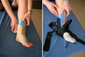 En l'absence de déformation ou de fracture ouverte, on confond souvent la fracture avec une entorse. Soccer Et Entorse A La Cheville Prevention Et Traitements Oppq