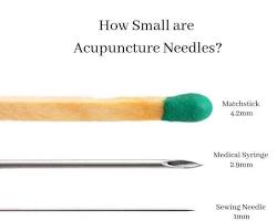 Image of acupuncturist with needles