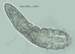 Bird Mites In Hair Https Encrypted Tbn0 Gstatic Com Images Q Tbn 3aand9gctya69fyuken 8nsvoevceew 6tiu62pynj9g Usqp Cau