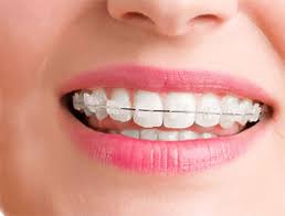 Maybe you would like to learn more about one of these? I Want To Get My Teeth Straightened And Want To Know The Cost Of Dental Braces In Jaipur Face Kraft Clinic