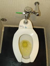 We did not find results for: Urine Wikipedia Bahasa Indonesia Ensiklopedia Bebas