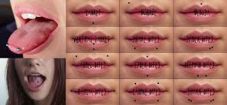 pin on oral appliances