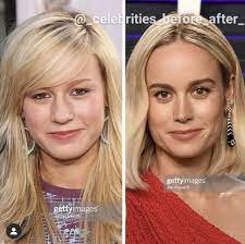 Happy face png is about is about brie larson, plastic surgery, rhinoplasty, surgery, cheek. Brie Larson Nose Job Aesthetic Hair Nose Job Celebrity Plastic Surgery