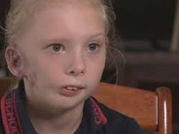 Technology: Queensland girl 10 has ear reconstruction using 3D printed ear
