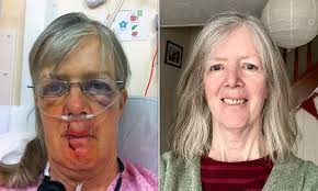 I nearly died after being trampled by a herd of vicious cows