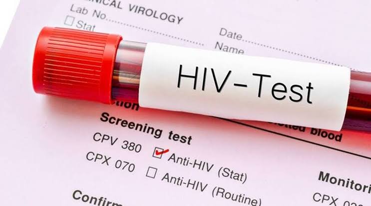 66-year-old man becomes the fourth patient in history to be cured of HIV