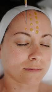 Has summer left your skin feeling dry, dull or congested? Pigmentation,  breakouts, and dead skin build-up are common post-summer