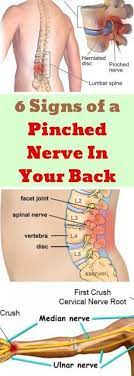 Pin On Nerve Pain Down Leg