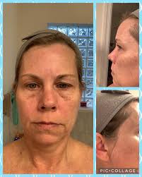 Bariatric Surgery Progress and Transformation