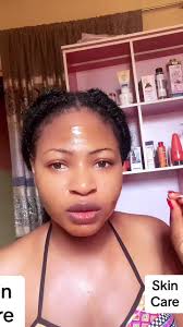 Honey for Sunburn Before and After