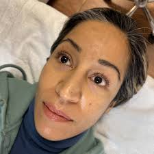 Amanda Rose, Advanced Aesthetician