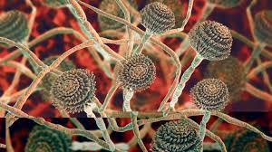 Mukor ist eine mikrobielle gattung von rund 40 arten von schimmelpilzen, die. Schwarzer Pilz Mukormykose Erste Falle Ausserhalb Indiens Nachster Seuchen Horror Breitet Sich Aus News De