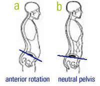 Beware Of The Anterior Pelvic Tilt Pmir
