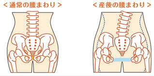 産後の骨盤の歪み問題、ここまで歪んだら普通死んじゃうよ〜！！｜院長ブログ｜五本木クリニック