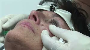 In prima faza, simptomele pot lipsi complet. Operatie Adenom Prostata Forum Recensioni Viferon Prostatite Forum