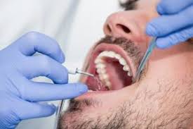Check spelling or type a new query. Why You Shouldn T Try To Remove Plaque By Yourself Dr John Michaels