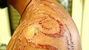 The incidence of allergic contact dermatitis to ppd is increasing, particularly in younger patients. Allergie Durch Schwarzes Henna Korperbemalung Mit Schmerzhaften Folgen Stammheim Stuttgarter Nachrichten