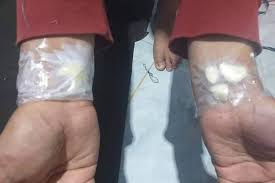 Doa untuk sembuhkan sakit gigi. Kata Dokter Soal Viral Tempel Bawang Putih Di Tangan Bisa Atasi Sakit Gigi Halaman All Kompas Com