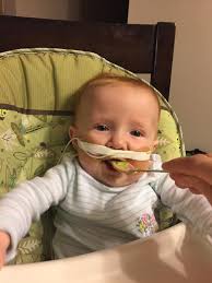 before and after nila hehe🫶😍 #CuteCDH