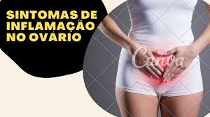 Sintomas De Inflamacao No Ovario Youtube