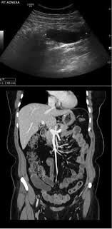 Pin On Xray Of The Week