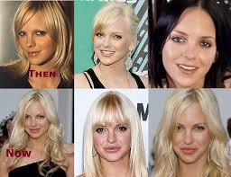 Anna Faris Plastic Surgery Plastic Surgery Kids Makeup Celebrity Plastic Surgery