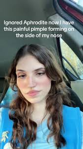 I just want clear skin😂