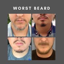 We didn't forget about...