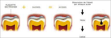 C'est une infection de la dent. Cabinet Medical Issy Les Moulineaux 92130 Medecine Generale Et Specialites Ophtalmologie Dentaire Medecine Esthetique