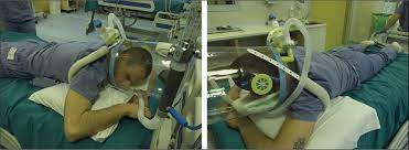 Pruning is a horticultural and silvicultural practice involving the selective removal of certain parts of a plant, such as branches, buds, or roots. Feasibility And Physiological Effects Of Prone Positioning In Non Intubated Patients With Acute Respiratory Failure Due To Covid 19 Pron Covid A Prospective Cohort Study The Lancet Respiratory Medicine