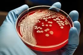 The affected area might be: This New Compound May Be Able To Battle A Common Hospital Superbug