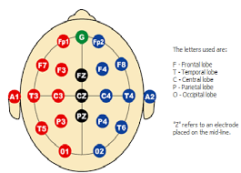 Depiction Of Electrode Placement In The Standard 10 20