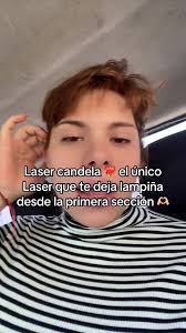 Lazerle Ben Alimi Iz Kalır Mı