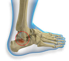 Image result for Talus