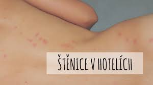 Štěnice domácí způsobuje štípnutí v řadách a po dvou a více štípancích. Stenice Na Co Si Dat Pozor Pri Cestovani A Jak Se Jich Zbavit Kdyz Si Je Privezete Z Dovolene