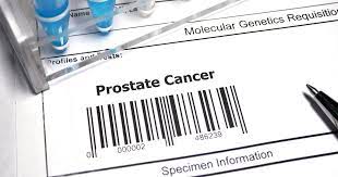 It may grow slowly and it's typically treatable. Prostate Cancer Treatment Advances Can They Help You Ctca