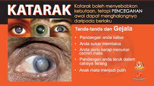 Seluruh lensa terkandung dalam kapsul kanta. Hannahrayyan Shoppe Katarak Mata Jangan Biar Sehingga Buta