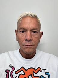 Full face fat graft is an effective and long-lasting way get a beautiful,  youthful face, by solving such problems as: 🔴 sunken areas 🔴 sagging skin  🔴 deep nasolabial folds 🔴 wrinkles