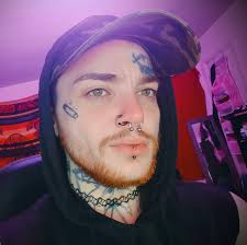 Anyone in here have Dr. Kassis in Nashville as their top surgeon?