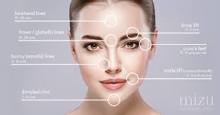 Botox Dysport For Jaw Reduction Lines Mizu Aesthetic