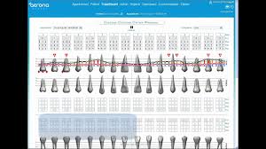 Periodontal Charting Youtube