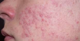 How to take care of a rash. Facial Rashes What S The Diagnosis Differential Diagnoses Guidelines In Practice
