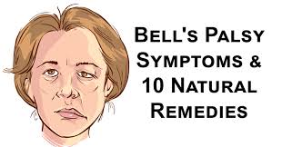 Share this article via email with one or more people using the form below. Bell S Palsy Symptoms 10 Natural Remedies David Avocado Wolfe